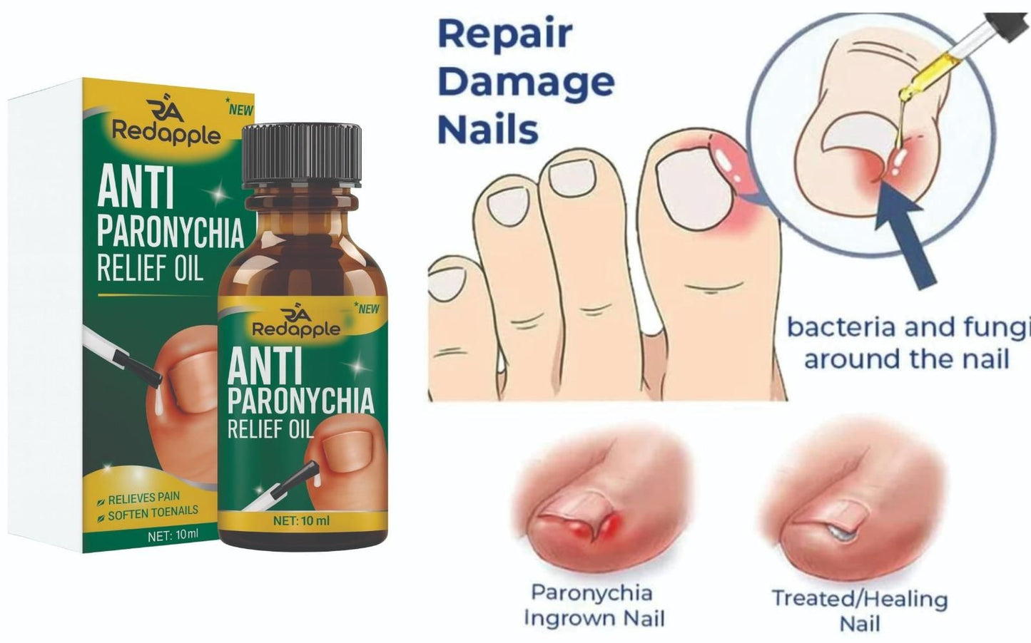 Nail Repair Oil (Anti Paronychia Relief Oil) Pack of 2
