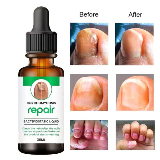 ADVANCED NAIL REPAIR SERUM 30 ML (PACK OF 1)